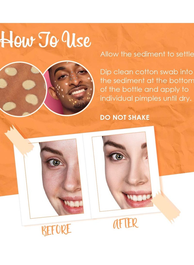 Bye Bye Blemish Vitamin C Dark Spot Brightening Lotion Treatment 30ml - Image 4