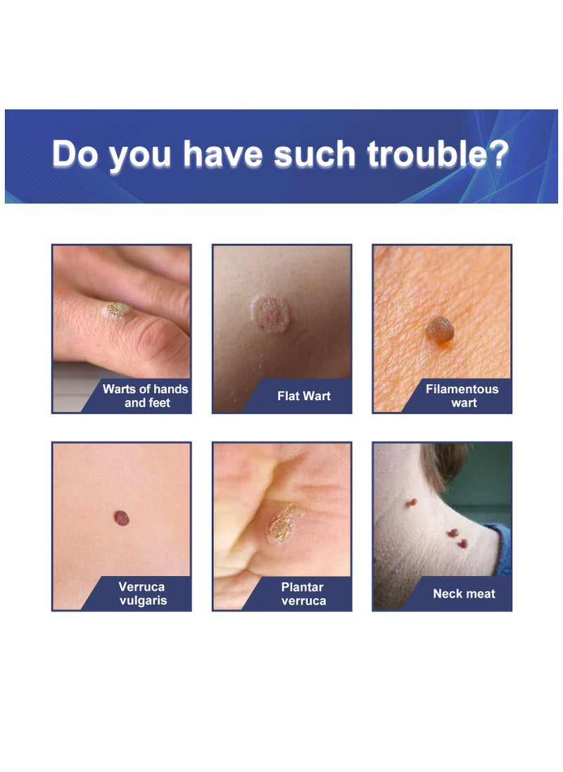 Jaysuing - Jaysuing Wart Control Patch Wart Elimination Mole Hand Foot Face Filamentous Warts Corns Flats Special Care Patch - Image 1