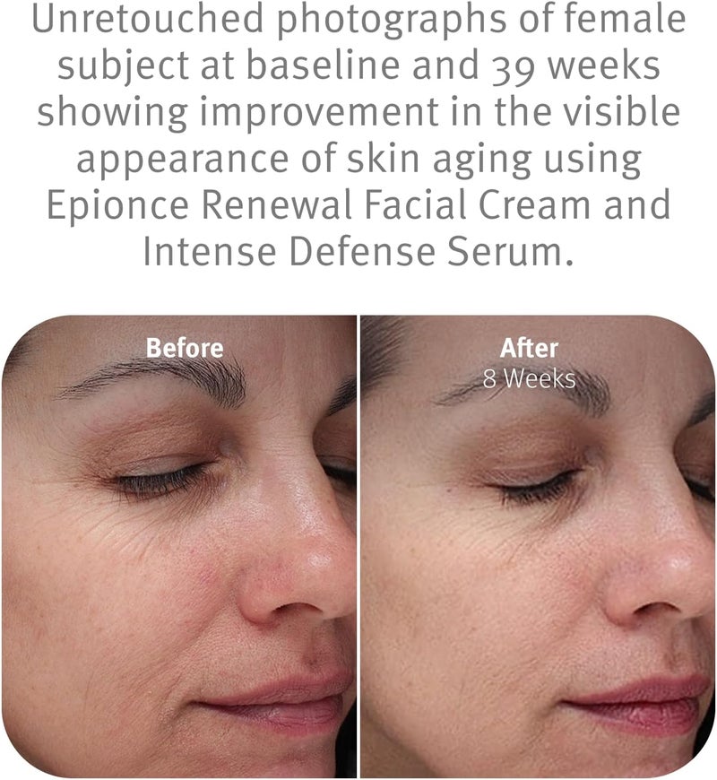 Epionce Renewal Facial Cream for Dry/Sensitive to Normal Skin - 50g/1.7oz - Image 4