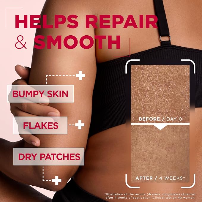 mixa Body Cream, Urea Cica Repair Renewing Cream For Dry Rough Skin 400ml - Image 3