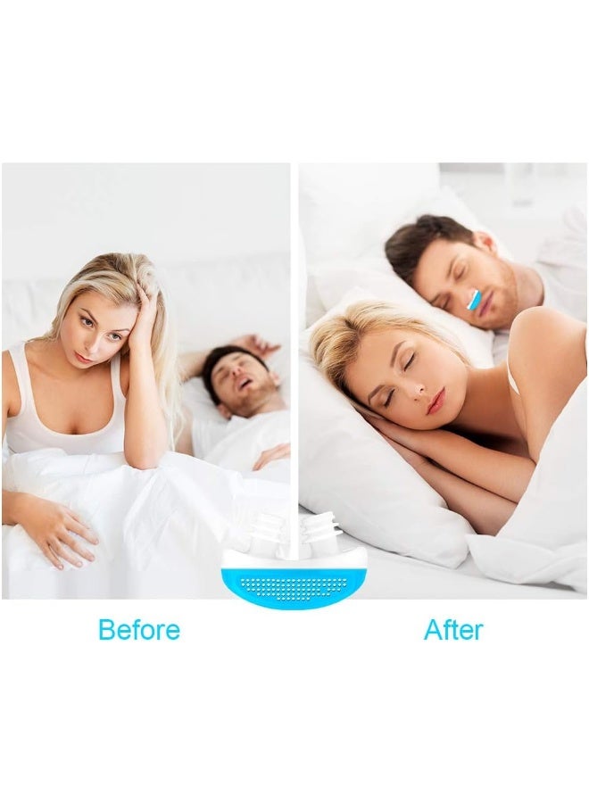 Seedom Anti Snore Nose Purifier Snoring Solution Mini Snore Stopper Snore Reducing Nose Vent - Image 4