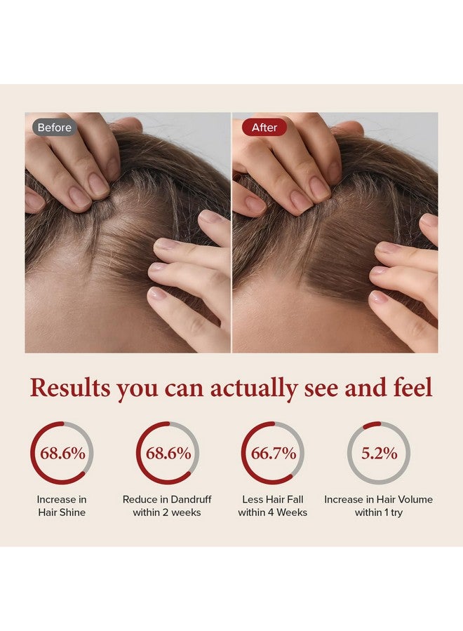 كاندال شامبو كوندال للشعر بالكافيين [زهر الكرز] للعناية بفروة الرأس، تنظيف عميق، مناسب لجميع أنواع الشعر، 500 مل - Image 5