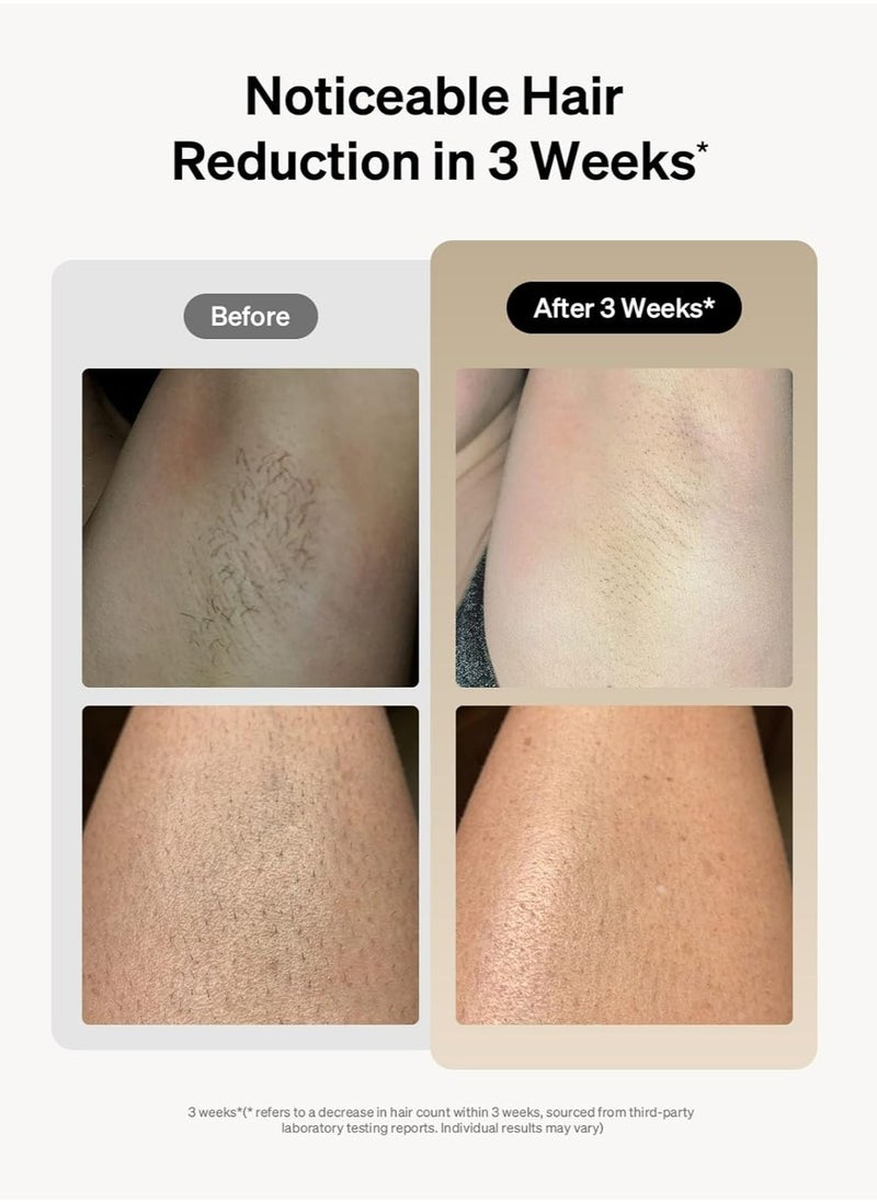 Ulike - Ulike Laser Hair Removal for Women and Men, Air 3 IPL Hair Removal with Sapphire Ice-Cooling System white - Image 1