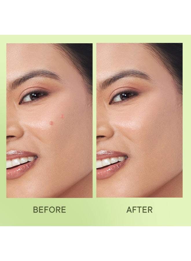 كوينش لاصقات "Quench Zit Away" لعلاج حب الشباب والبثور للوجه | 24 لاصقة هيدروكولويد غنية بحمض الساليسيليك ومستخلص عشبة "سيكا" المرمم | تعمل على تقليص حجم البثور بين عشية وضحاها | علاج لحب الشباب - 24 لاصقة - Image 4