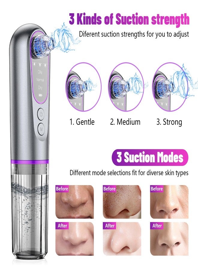 HOERCAAL Blackhead Remover Vacuum with Microbubble Cleaning, Facial Pore Extractor & Pro Cleanser Tool, 3 Suction Levels, 5 Replaceable Heads for Deep Cleansing & Skin Care - Image 2