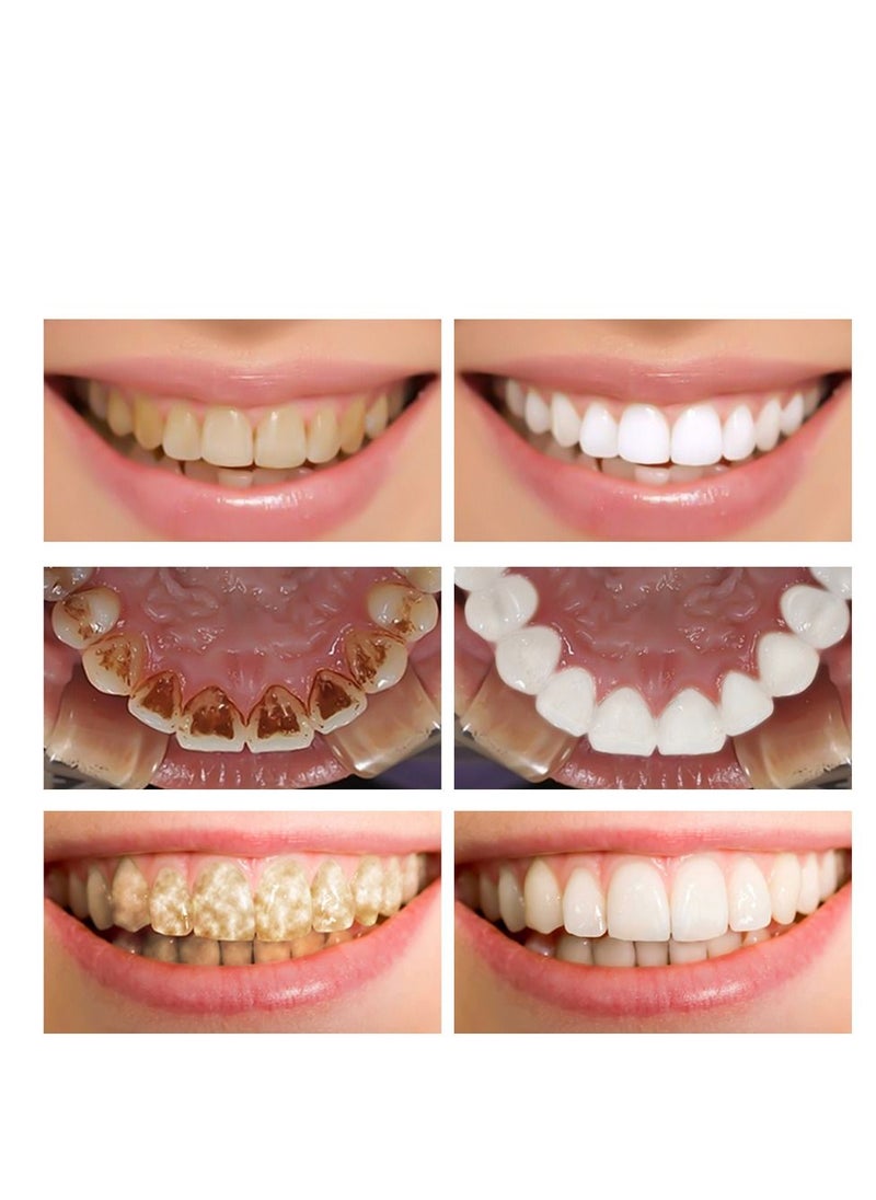 FTEENPLY - Teeth Whitening Essence Removes Plaque Stains Tooth Bleaching Cleaning Serum White Teeth Oral Hygiene Tooth Whitening 10ml - Image 1