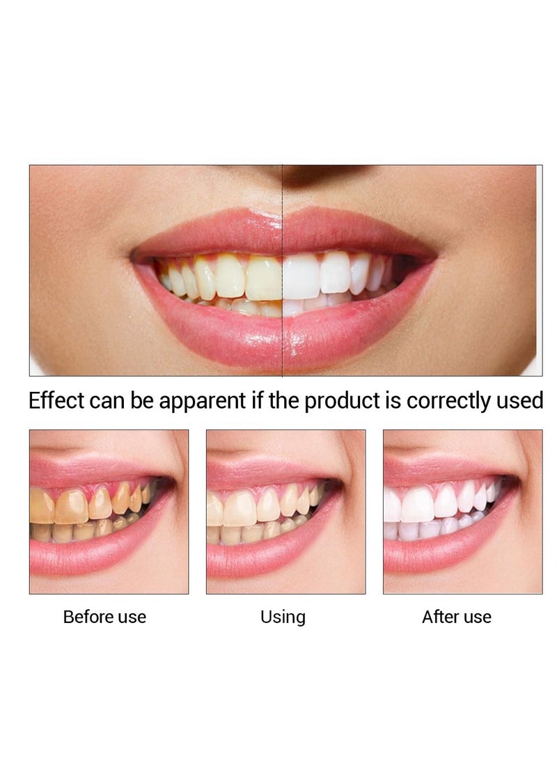 FTEENPLY - Teeth Whitening Essence Removes Plaque Stains Tooth Bleaching Cleaning Serum White Teeth Oral Hygiene Tooth Whitening 10ml - Image 1