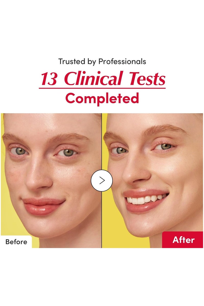 إيكوالبيري سيروم فيتامين لتفتيح البشرة - سيروم فيتامين سي مع النياسيناميد | يعزز حاجز البشرة | يرطب باستخدام السيراميد وحمض الهيالورونيك، 30 مل / 1.01 أونصة - Image 5