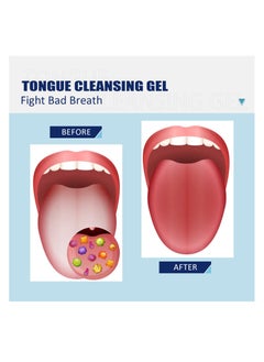 EELHOE Tongue Cleaning Gel Special Anti Bad Breath Tongue Cleaning Gel With Soft Tongue Brush, Easy  Use Tongue Scraper Precision Cleaning Brush Set  Keep Breath Fresh  - Image 2