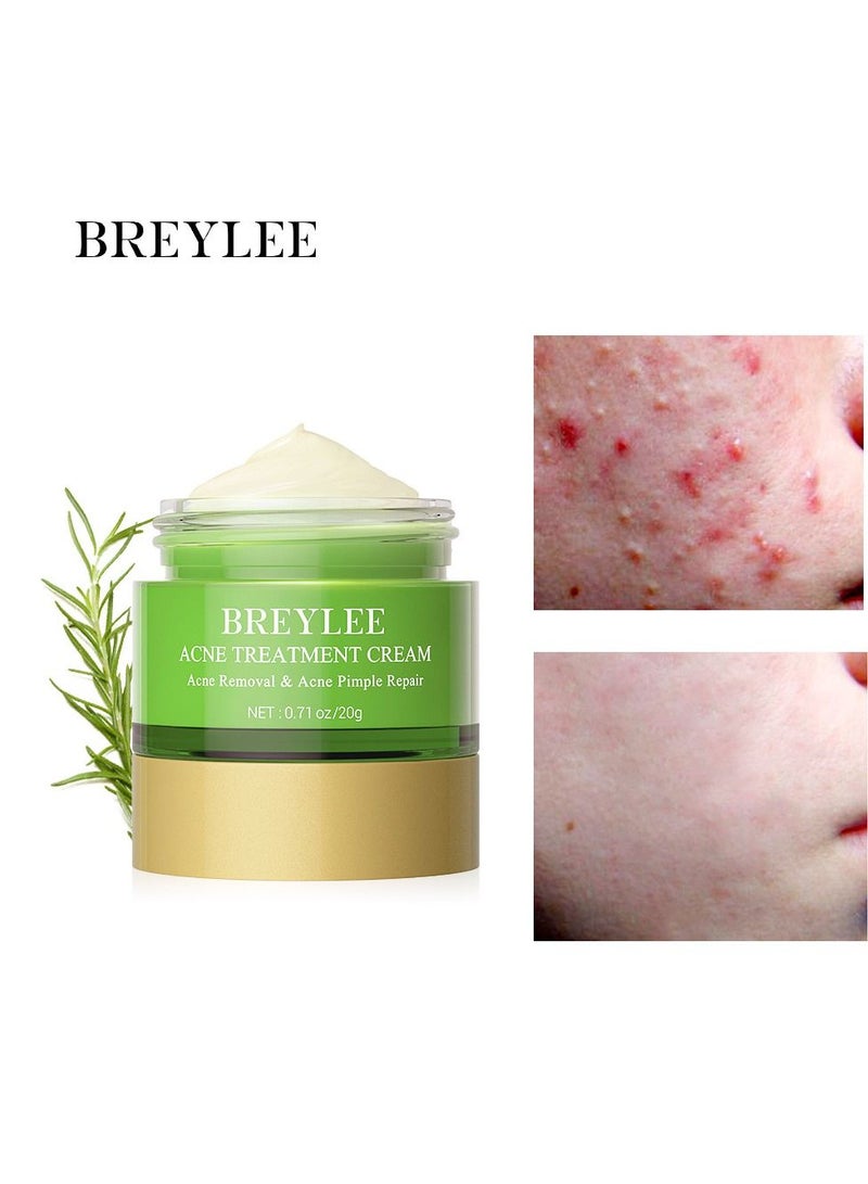 Breylee Acne treatment cream acne removal acne pimple repair cream 20g - Image 1