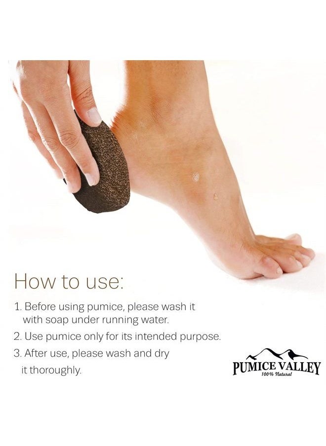PUMICE VALLEY - Pumice Stone for Feet Callus Remover - Earth Lava Foot Pumice Stone for Callous Warts Dead Skin Removal - Natural Exfoliating Stone Foot Scrubber for Dry Cracked Heels & Hands for Use in Shower - Image 1