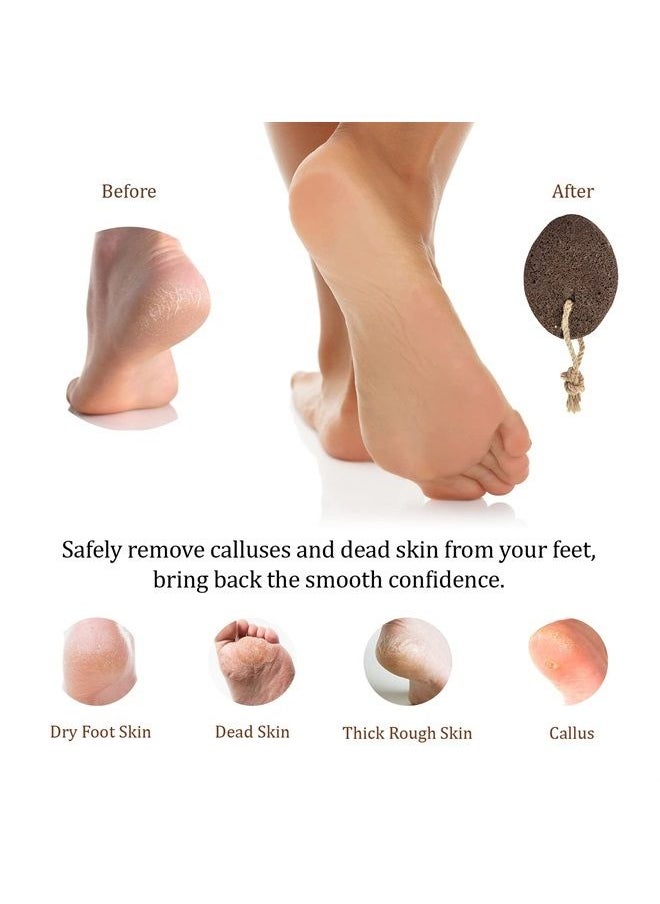 PUMICE VALLEY - Pumice Stone for Feet Callus Remover - Earth Lava Foot Pumice Stone for Callous Warts Dead Skin Removal - Natural Exfoliating Stone Foot Scrubber for Dry Cracked Heels & Hands for Use in Shower - Image 1