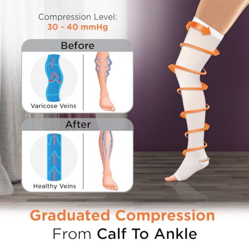 Vissco Anti-Embolism Stockings - Thigh Length - Open Toe (Above Knee), Leg Compression Stocking to Improve Blood Circulation, Swollen, Tired, Aching Legs - Medium (White) - 1 Pair - Image 3