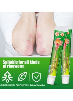 HBESTY Natural Chinese Herbal Eczema Ointment, Dermatitis And Eczema Pruritus Psoriasis Ointment, Psoriasis Creams, Psoriasis Treatment, Antibacterial Cream For Body Itching 20G  - Image 3