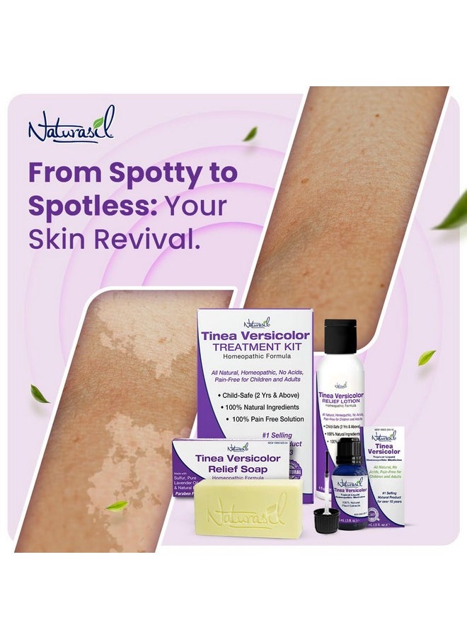 Naturasil - Tinea Versicolor Treatment +2 Bars | Max-Strength 10X Soap | Antifungal Micronized Sulfur | Stops Pityriasis, Candida, Ringworm & Irritation | Fast Acting Adult & Kid Safe | 4 Oz (2 Pack) - Image 1