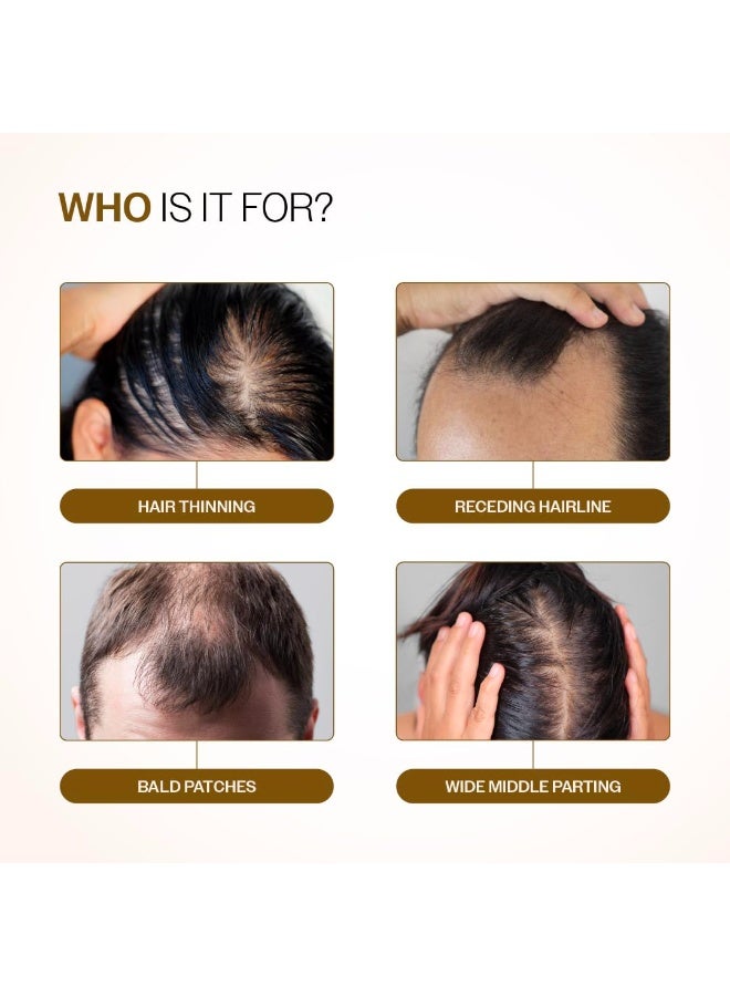Bare Anatomy Advanced Hair Growth Serum Roll-On| 3% Redensyl + 4% Anagain + 2% Baicapil + 5% Rosemary, Rice Water, Biotin & Saw Palmetto| Reduces Hair Fall, Supports Hair Growth for Men & Women | 25ml - Image 3