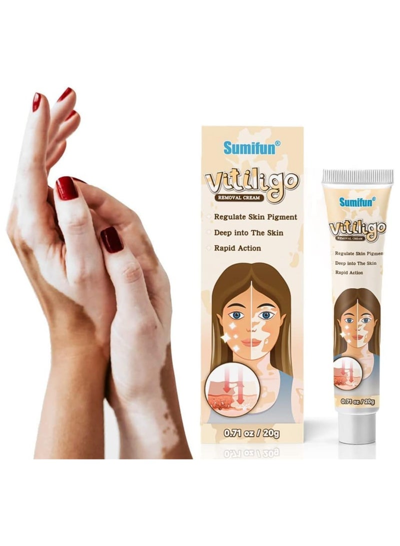 سوميفون كريم العناية بالبشرة فيتيليغو ، يقلل من البقع البيضاء ، وتحسين صبغة الجلد - Image 1