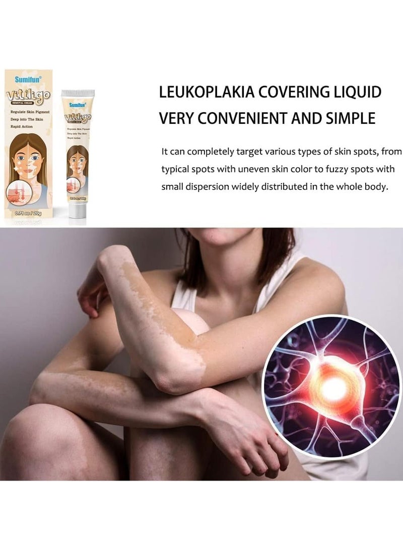 سوميفون كريم العناية بالبشرة فيتيليغو ، يقلل من البقع البيضاء ، وتحسين صبغة الجلد - Image 3