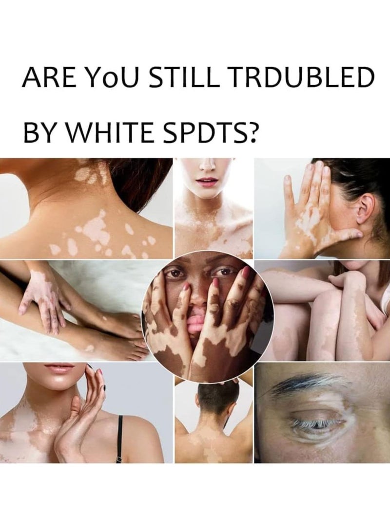 سوميفون كريم العناية بالبشرة فيتيليغو ، يقلل من البقع البيضاء ، وتحسين صبغة الجلد - Image 5
