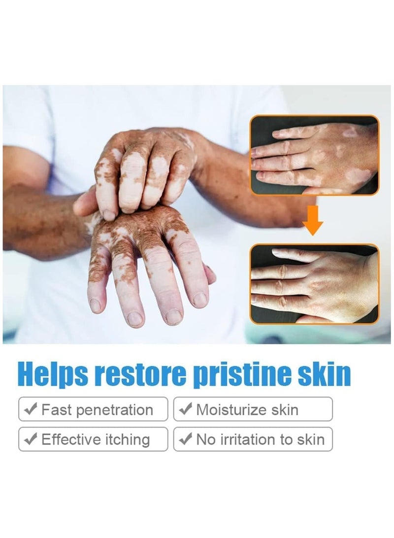 سوميفون كريم العناية بالبشرة فيتيليغو ، يقلل من البقع البيضاء ، وتحسين صبغة الجلد - Image 2