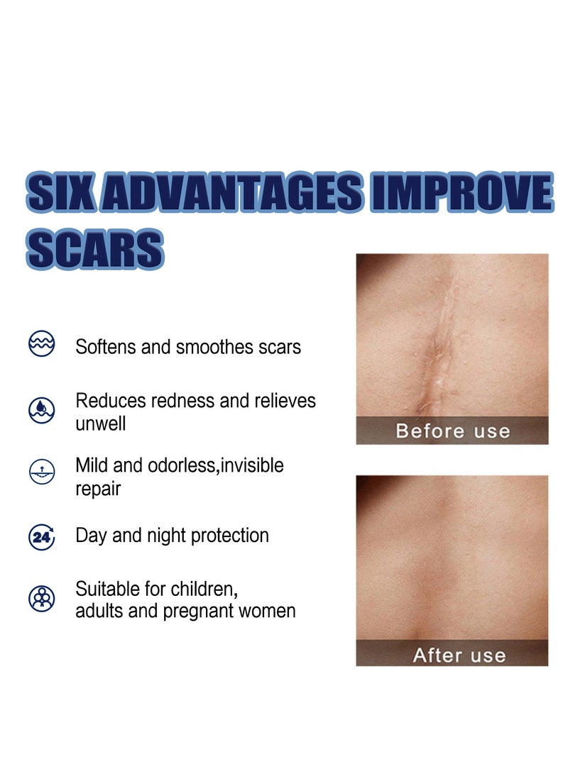 إيلهو كريم إزالة الندبات بمركب دايميثيكون 2% تأثير سريع لحرق الحمل الجديد والقديم وندبات العمليات لإصلاح الجلد التالف وتغذيته وتفتيحه 50 مل - Image 2