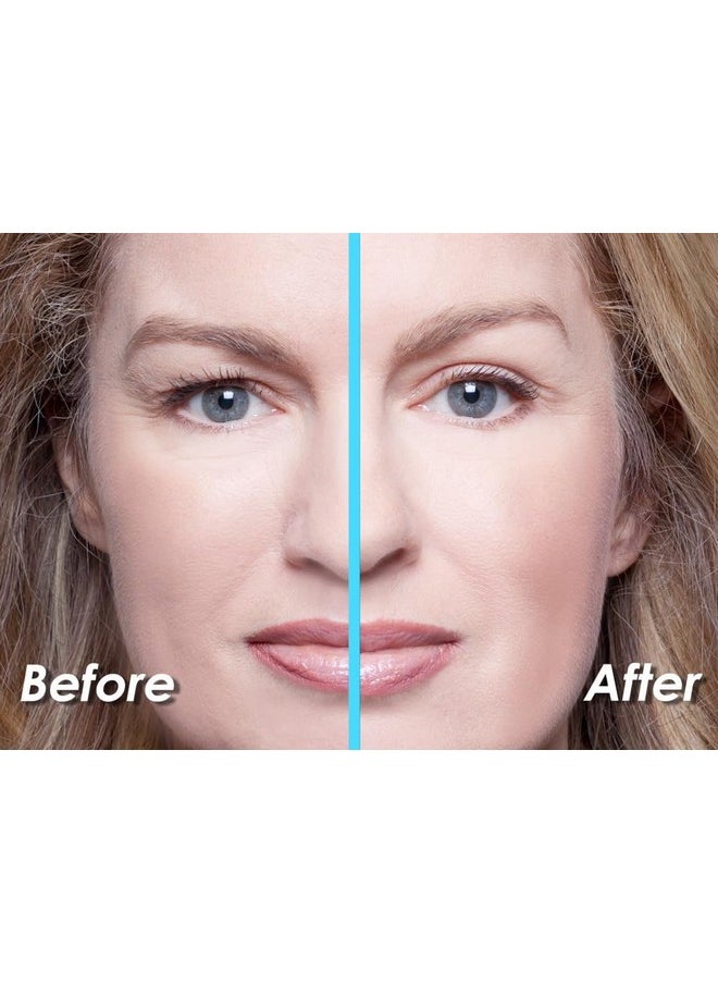 Eye Magic - Premium Eyelid Lift (L/Xl Kit + Gel) Made In America Lifts And Defines Droopy, Sagging Or Hooded Eyes Safe For Daily Use - Image 1
