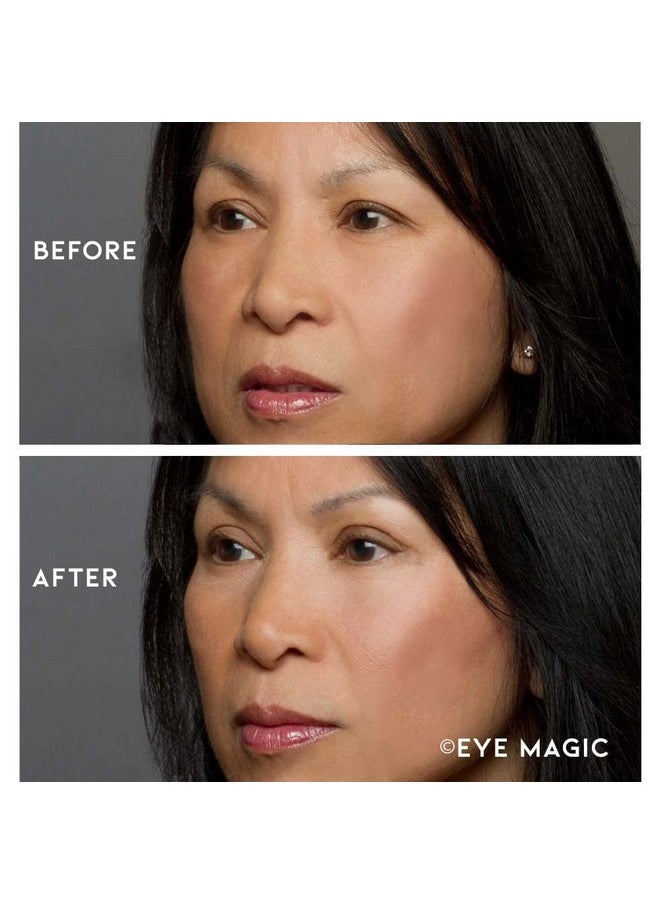 Eye Magic - Premium Eyelid Lift (L/Xl Kit + Gel) Made In America Lifts And Defines Droopy, Sagging Or Hooded Eyes Safe For Daily Use - Image 1