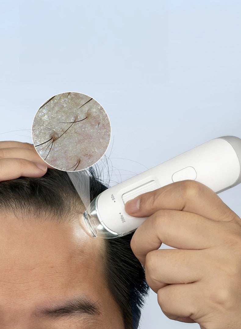 general Scalp Follicle Detector Hair Care Salon Home Use HD Handheld Portable USB Skin Analyzer - Image 2