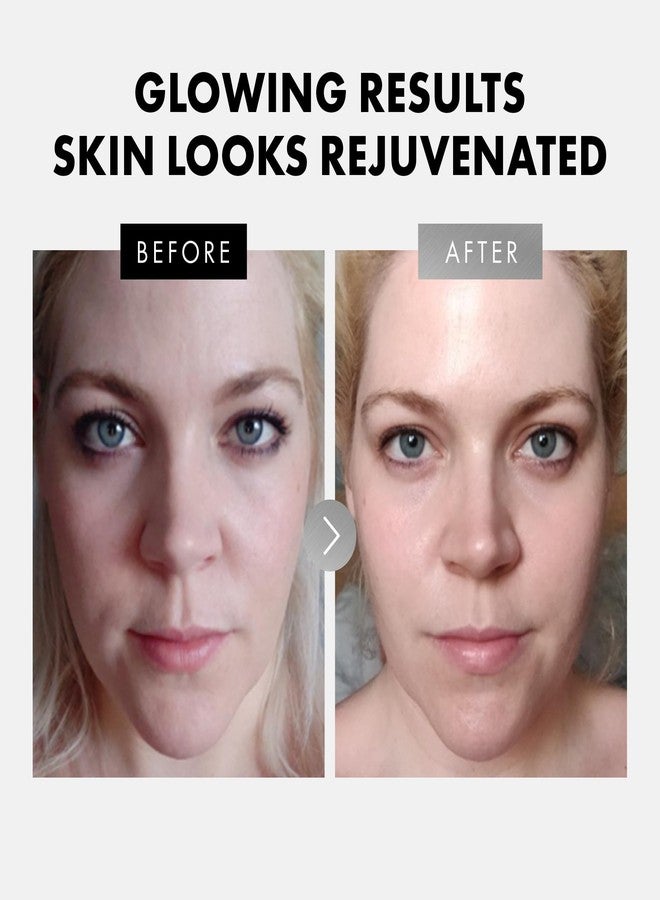 Eclat Skincare Face Serum Set - Vitamin C, Retinol, Hyaluronic Acid for Hydration & Anti-Aging - Brightening & Firming Facial Serums - 3 Pack Face Care Set - Image 5