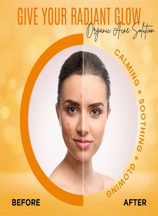 DERMAXGEN Organic Turmeric Soap Bar for Face & Body - Pure Turmeric Soap Bar for Acne, Scars, Uneven Tone, Blemish Control, Sun Damage & Age Spots - Handcrafted Skincare - (Pack of 6) - Image 5