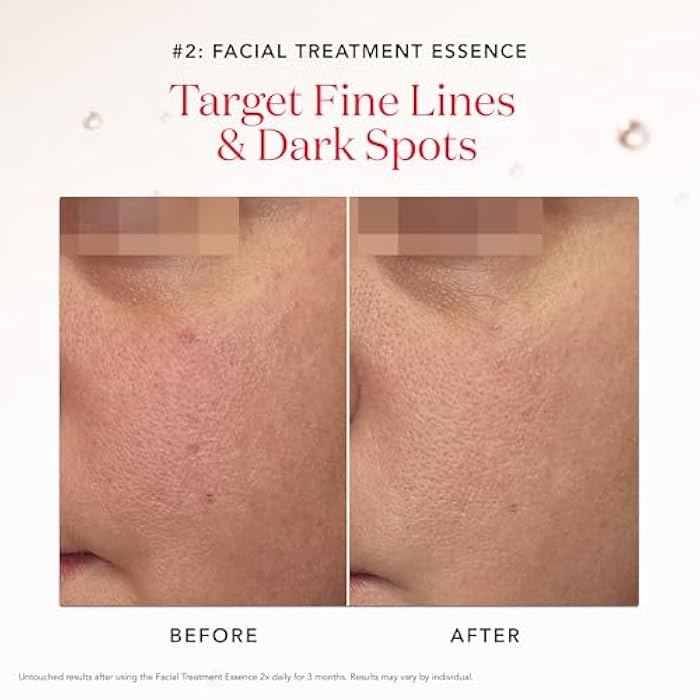 SK-II Ultimate Aura Skincare Kit - Radiance-Boosting Skincare Gift Set with Travel & Full Size Products - Kit Includes Full Size Facial Treatment Essence, Mini Cleanser & Mini Essence Serum (3 Count) - Image 3