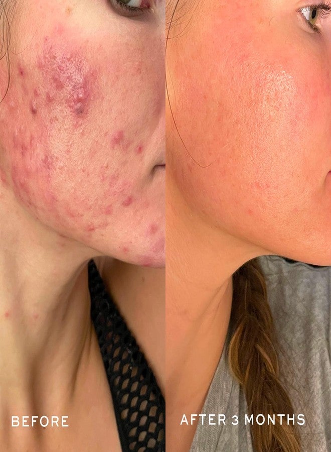 DIME Beauty Creamy Foam Cleanser, Foaming Face Wash, Daily Salicylic Acid Facial Cleanser for Oily Skin, 4 oz / 120 m - Image 4