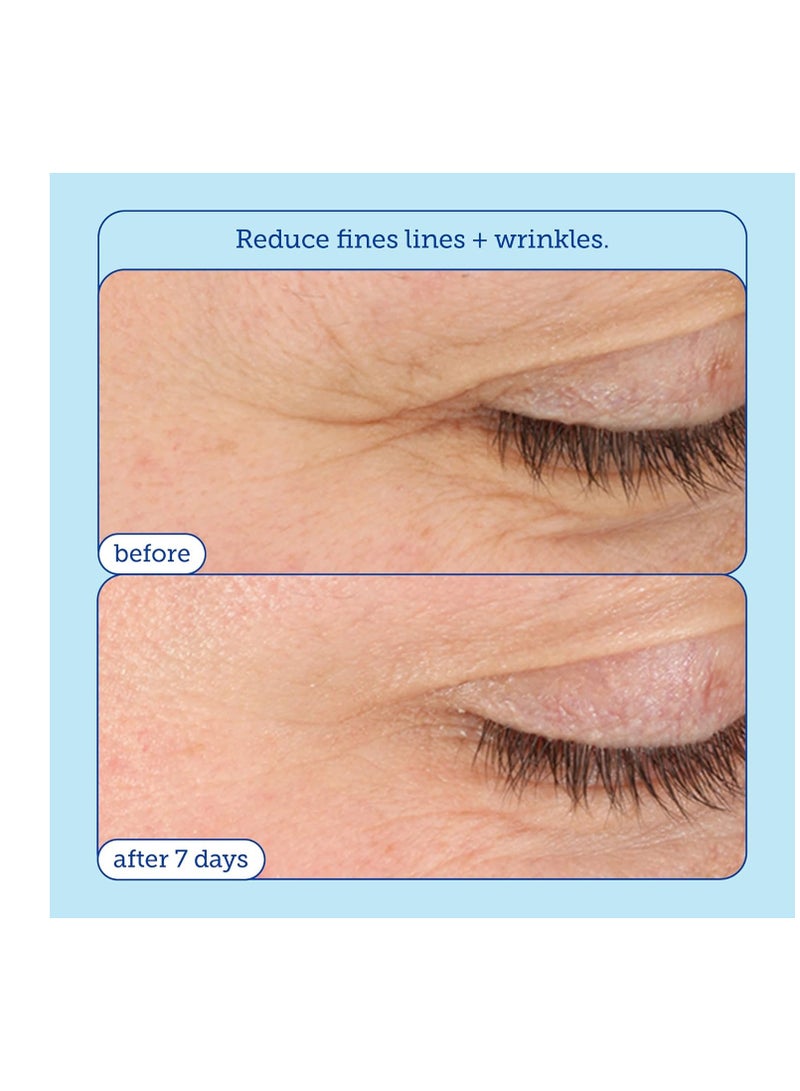 Skinfix Skinfix Barrier+ Triple Lipid-Boost 360° Eye Cream: Targets Dark Circles, Puffiness, and Fine Lines Around Eyes and Lids, Clinically Proven to Brighten and Refresh Eyes, 0.5 oz  - Image 3