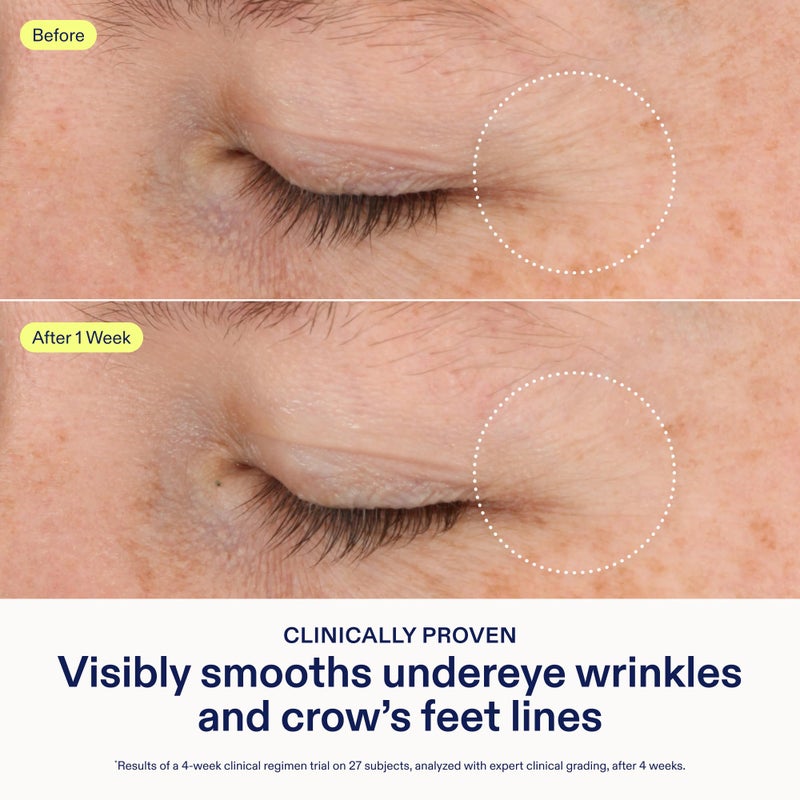 Skinfix Triple Lipid-Boost 360 Eye - 0.5 fl oz - Visibly Smooths Undereye Wrinkles & Crowâ€™s Feet Lines with Hyaluronic Acid - Non-Comedogenic - Vegan, Cruelty Free - Founded in Canada - Image 3