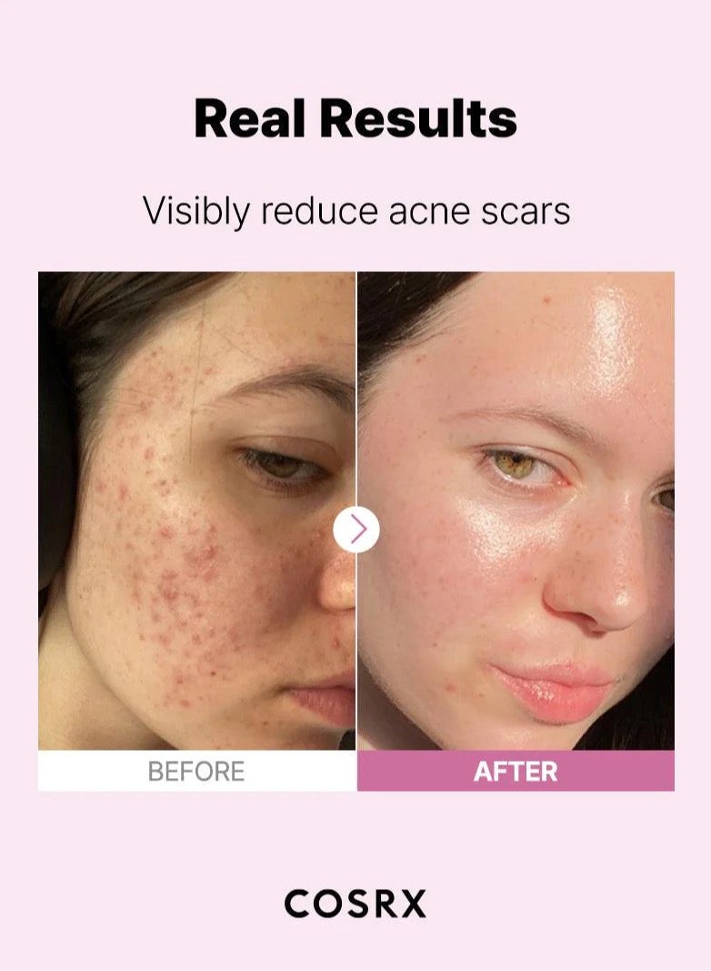 COSRX Complete Skincare Routine & Face Massage Roller - Advanced Snail 96 Mucin Power Essence, Snail 92 All in One Cream, Retinol 0.1 Cream, Niacinamide 15 Serum, and 6 Peptide Skin Booster Serum 390ml - Image 2