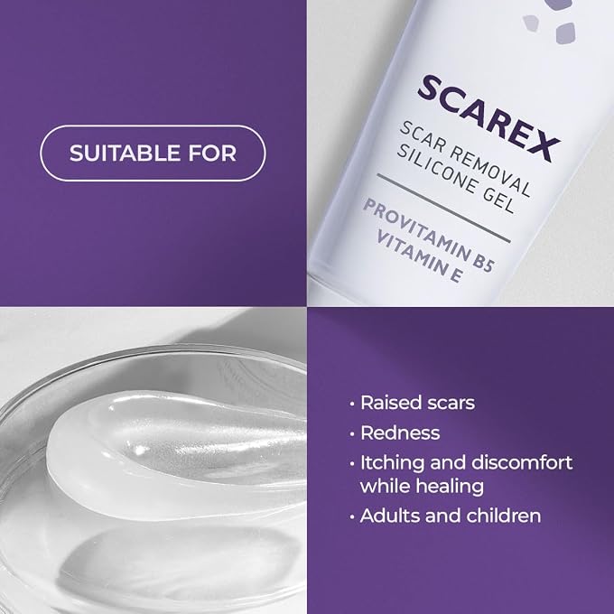 Biotrade Scarex Silicone Gel - After Injuries Surgery Burns Anti Scars 15ml - Image 2