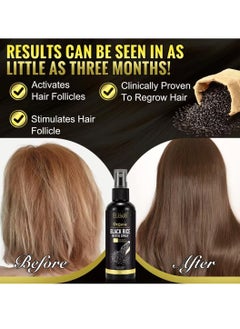 ELBBUB 120ml Organic Black Rice Water Spray with Castor Oil Biotin for Hair Growth Hair Regrowth Treatment for Thicker Fuller Hair Growth Hair Growth Serum Rice Water Spray for Damaged Hair  - Image 3