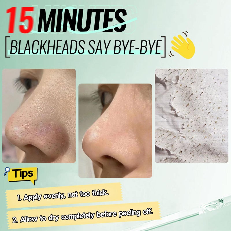 SYABO 2.0 Nose Pore Strips, Blackhead Remover Mask with Salicylic Acid for Face, Upgraded Deep Cleansing Pore Peel Off Mask with 100 PCS Nose Black Heads Remover Strips (1.7 Ounce) - Image 5