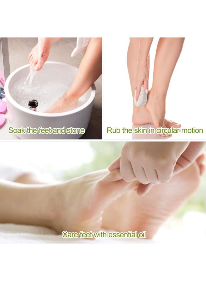 2PCS Natural Pumice Stone for Feet and Hands – Callus Remover & Exfoliating Foot File – Pedicure Tools for Removing Hard, Dead, and Dry Skin – Durable, Easy to Use, Hanging Rope Design - Image 3