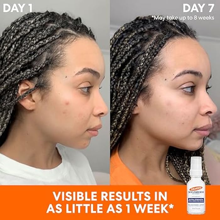 Palmer's Skin Success Extra Strength Tone Correcting Face Serum, 1.0 Fl Oz, Dark Spot Corrector for Discoloration, Age Spots and Post-Acne Marks - Image 4