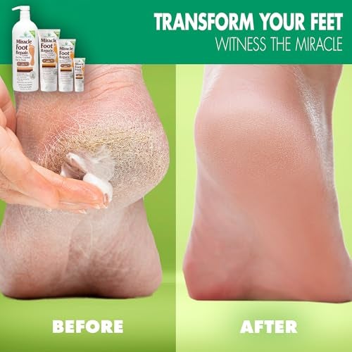 Miracle of Aloe كريم إصلاح القدم المعجزة 1 أونصة 12 عبوة يصلح الكعوب والقدمين الجافتين والمتشققتين 60 ألوة نقيّة مرطبة وملينة وإصلاحية - Image 5