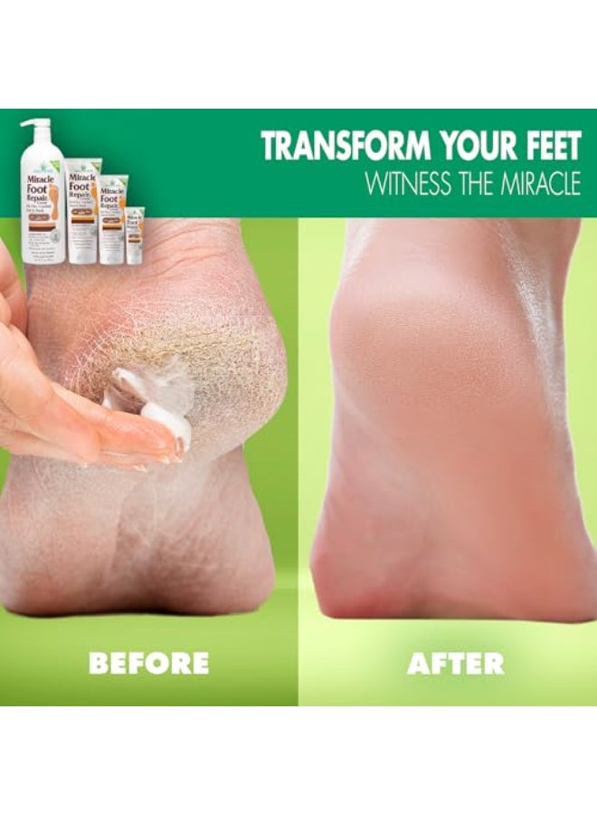 Miracle of Aloe كريم إصلاح القدم المعجزة 1 أونصة 12 عبوة يصلح الكعوب والقدمين الجافتين والمتشققتين 60 ألوة نقيّة مرطبة وملينة وإصلاحية - Image 4