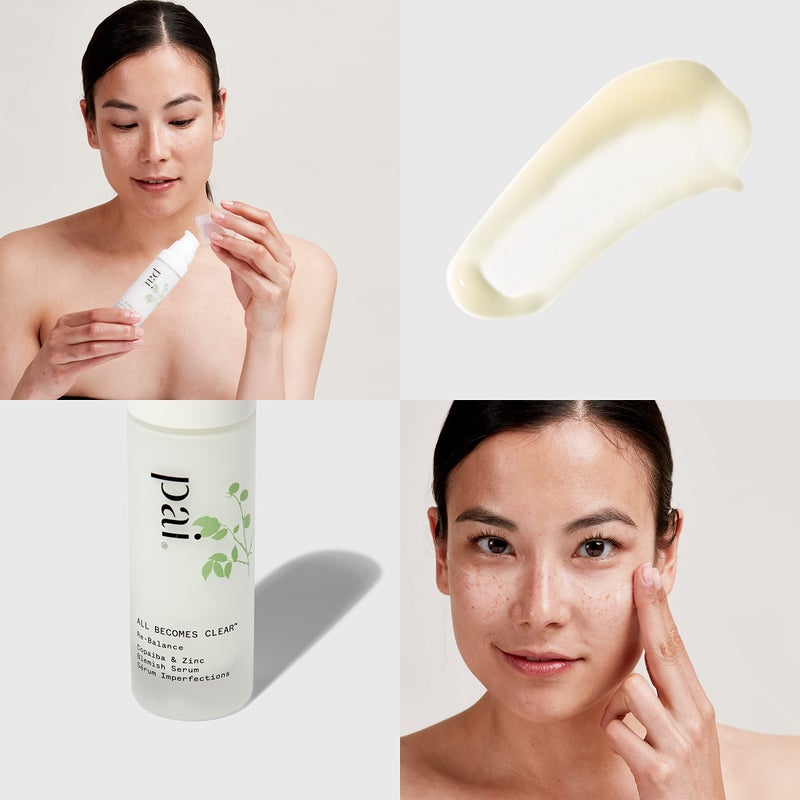Pai Skincare - All Becomes Clear: Organic Copaiba + Zinc Blemish Serum | Natural, Vegan, Sensitive Skincare (1 fl oz | 30 mL) - Image 2