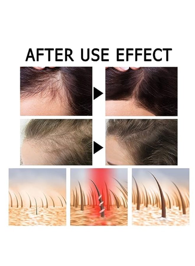 EELHOE Hair Strength PRO Ampoules – Scalp Nourishing & Hair Follicle Support, Hydrating & Soothing Formula for Stronger, Healthier Hair, Easy Application, Suitable for Hair Loss and Thinning Concerns - Image 5