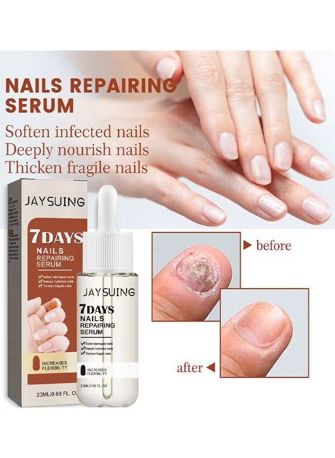 Jaysuing 7Days Nails Repairing Serum, Nail Nutrient Oil Strengthener Oil Serum Nail Growth Oil, Nail Cuticle Oil Strengthener, Nail Serum For Growth And Repair For Damaged Nails, 20ML - Image 3