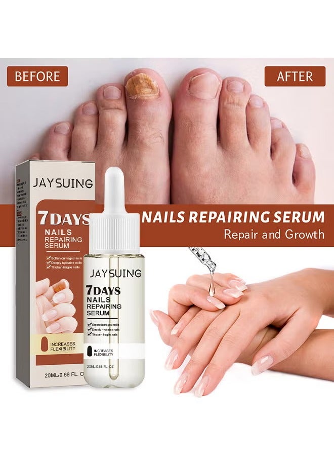 Jaysuing 7Days Nails Repairing Serum, Nail Nutrient Oil Strengthener Oil Serum Nail Growth Oil, Nail Cuticle Oil Strengthener, Nail Serum For Growth And Repair For Damaged Nails, 20ML - Image 4