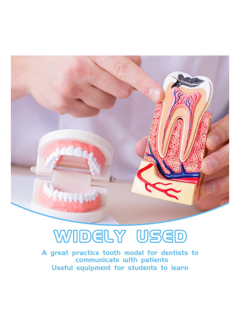 SYOSI - 2PCS Educational Dental Teaching Model, Dental Study Mouth Model Toy Dental Teeth Display Fake Dentures Demonstration Tool Dentures Demonstration for Kids Dental Teaching Study Supplies - Image 1