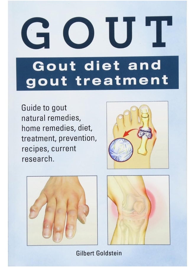 Gout. Gout diet and gout treatment. Guide to gout natural remedies, home remedies, diet, treatment, prevention, recipes, current research.  - Image 3