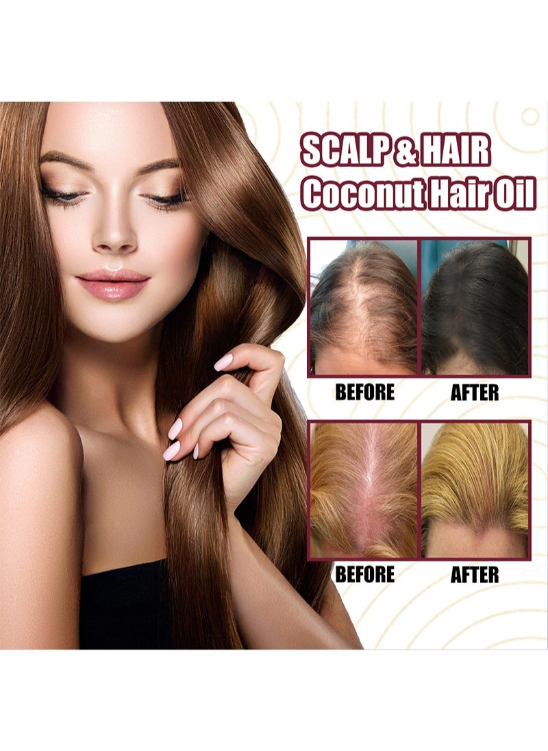 OUHOE 2Pcs Premium Red Onion Hair Oil，Onion Thickening Spray，Hair Oil with Onion Extract Onion Hair Growth Products for Men and Women Rapid Growth Anti-Hair Loss  - Image 3