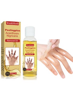 West&Month Peeling Plus-Acanthosis NigricansRremoval Oil,Dark Spot Corrector Oil, Acanthosis Nigricans Treatment For Dark Knuckle Finger Elbow And Knee Removal 50ML  - Image 1